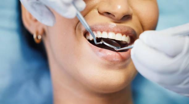 Best Pediatric Emergency Dentist in Anacortes, WA